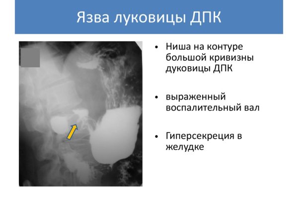 Kra39.at Вход на сайт главная страница